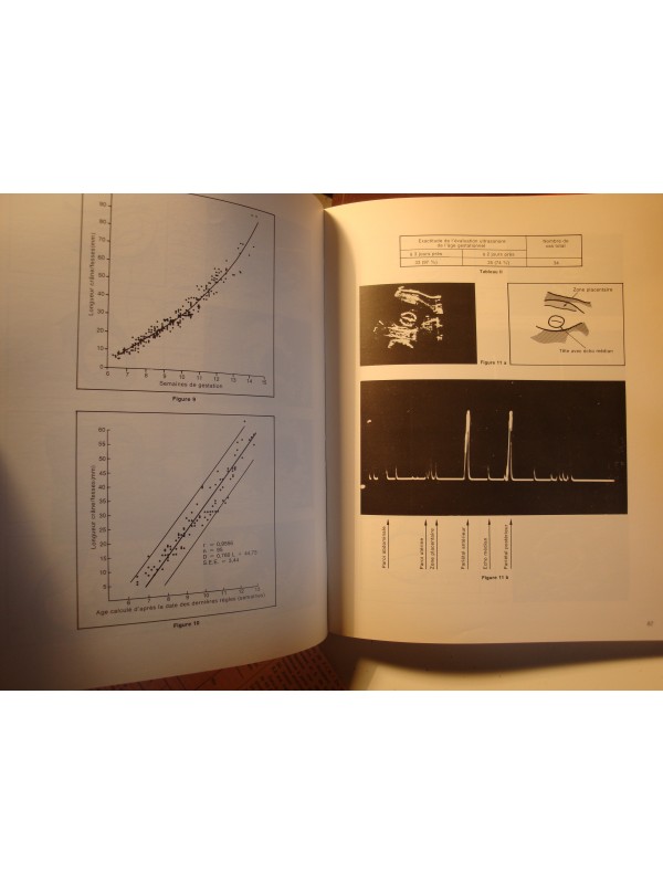 HOPITAL ESQUIROL echotomographie en obstétrique et gynécologie 1975 Glaxo++
