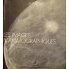 A. WILLEMIN mammographic appearences - images mammographiques 1972 KARGER++ A. WILLEMIN mammographic appearences - images mammographiques 1972 KARGER++